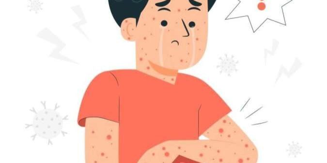 Mempercepat langkah eliminasi Penyakit Tropis, target bebas pada 2030

