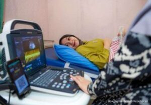 Alat ultrasonography (USG) membantu pemeriksaan kehamilan ke Puskesmas sebagai upaya deteksi dini