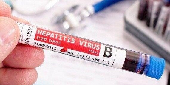 Hepatisis B dan Anti HCV pada Hepatitis C


