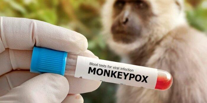 Monkeypox atau cacar monyet - Di dalam surat edaran tersebut, Kemenkes mengingatkan agar tidak hanya mewaspadai penularan antar manusia. 


